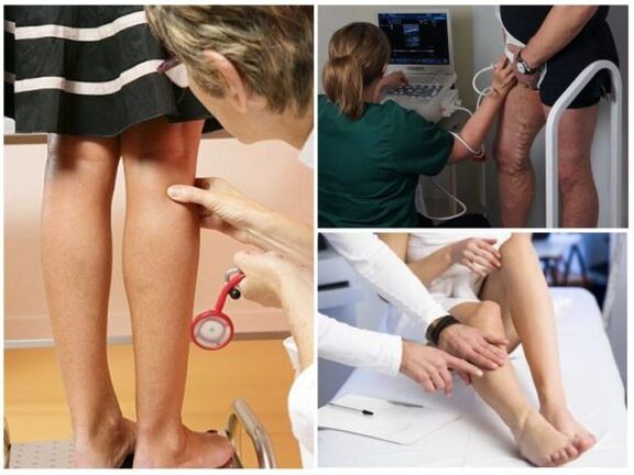 Diagnóstico de varices
