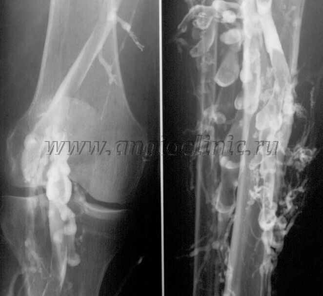 Exploración de ultrasóns